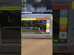 Zobacz, dlaczego warto wybrać ekran LCD monitora pacjenta Mindray BeneView T1 z przednią pokrywą