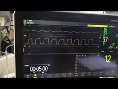 Zobacz wersję demonstracyjną modułu Mindray AG Moduł AG i O2 Moduł MMS PN 115-023943-00